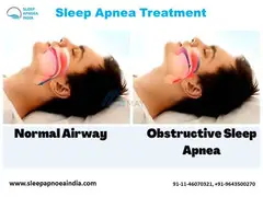 Sleep Apnea Test - 1