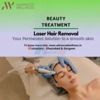 Laser hair removal in Gurgaon - 1