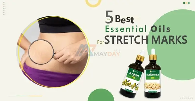 Best Oils for Stretch Marks - 1