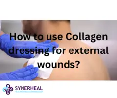 How to use Collagen dressing for external wounds?