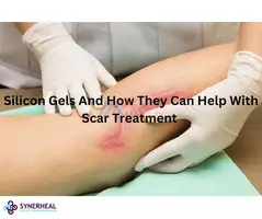 Silicon Gels And How They Can Help With Scar Treatment
