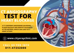 CT Coronary Angiography Test At Best Price Near me In Delhi - 1