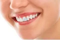 Best dental clinic in Doha | Hollywood smile | General & Advanced Dental Care